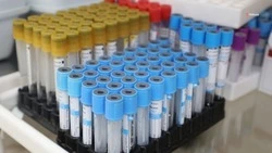 В Ставропольском крае 680 человек заразилось ковидом за сутки