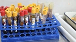 На Ставрополье показатель заболеваемости ВИЧ-инфекцией за год снизился на 4,6%